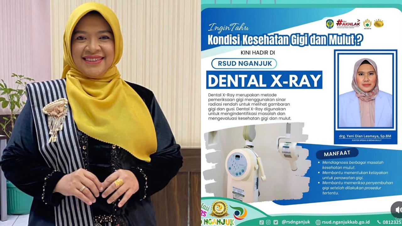 RSUD Nganjuk Hadirkan Fasilitas Dental X-Ray untuk Kesehatan Gigi dan Mulut, Ini Mafaatnya